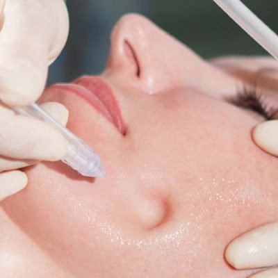 Reviderm_Hydroporation