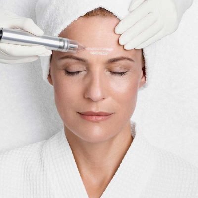 Reviderm_Mikrodermabrasion