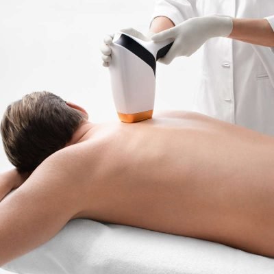 laser-haarentfernung-reviderm-3